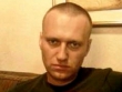 «Спасите Алексея Навального!» Главного оппозиционера после покушения «добивают» в колонии